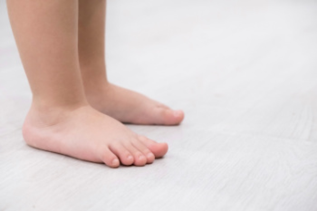 Flat Feet in Children and Teenagers